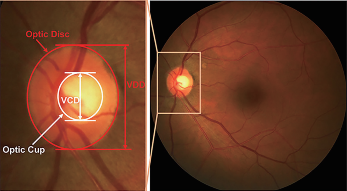 Annals of Eye Science_4