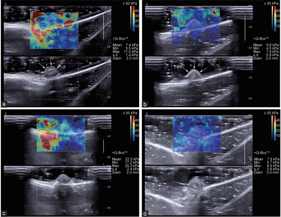 Asian Journal of Andrology_4