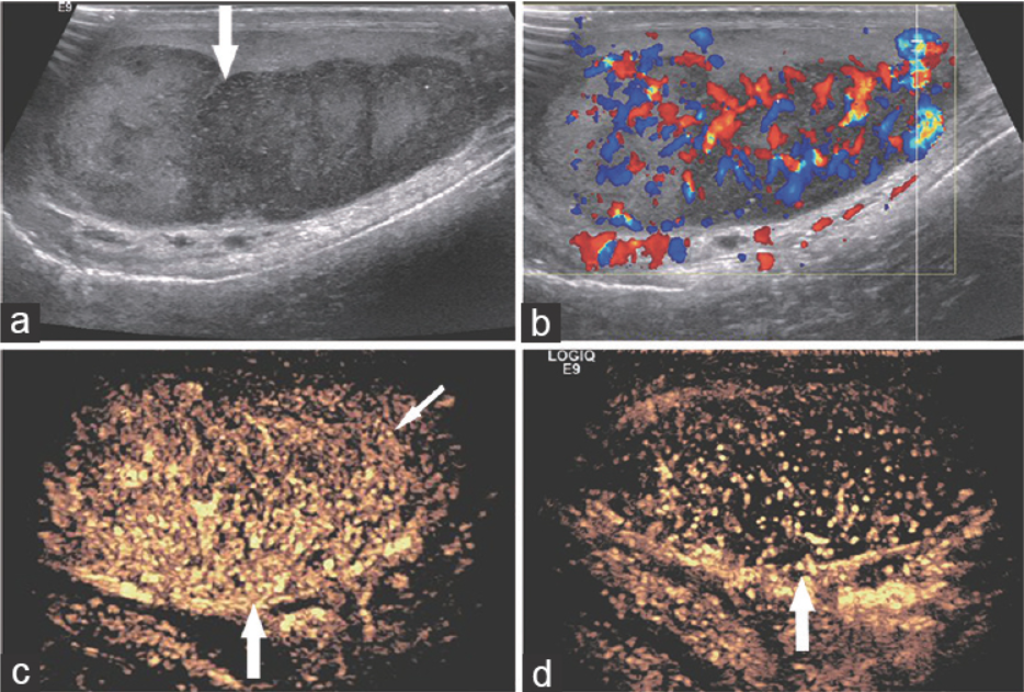 Asian Journal of Andrology_4