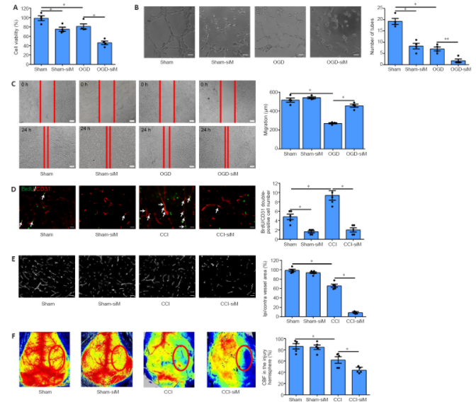 Neural Regeneration Research_3