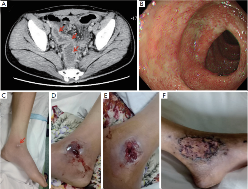 AME Medical Journal_4